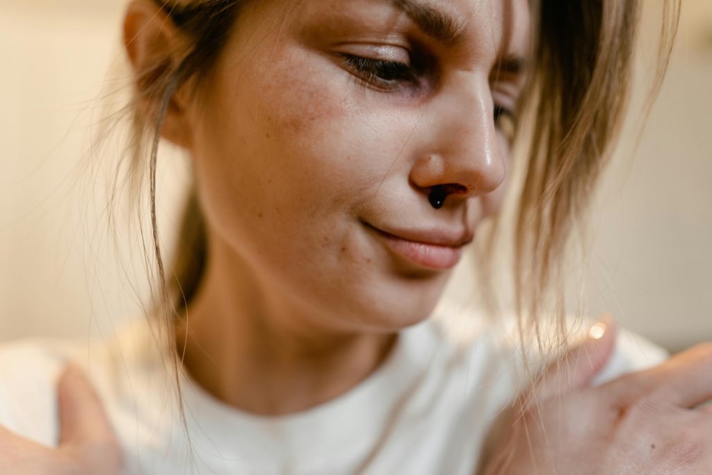 Emotionally intense close-up portrait of a woman with a nose injury, depicting vulnerability.